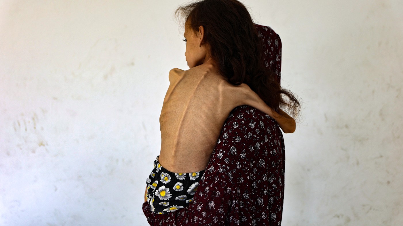 Israel is carrying out reproductive genocide against Palestinians