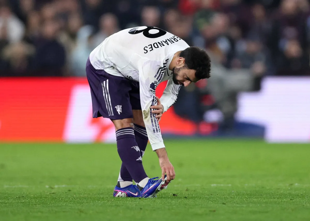 Amorim Fears United Captain Fernandes Will Be Out a While 020 Amorim Fears United Captain Fernandes Will Be Out a While